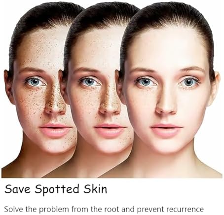 Aobenz Radiant Skin Revitalizing Serum™