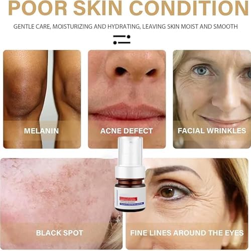 Aobenz Radiant Skin Revitalizing Serum™